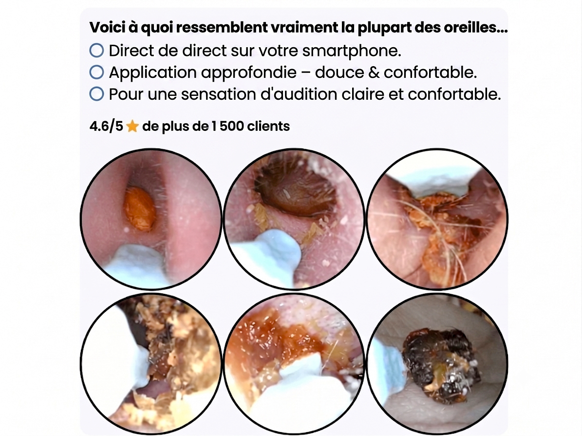 Otoview Ear Wax PRO