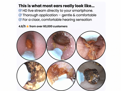 Otoview Ear Wax PRO
