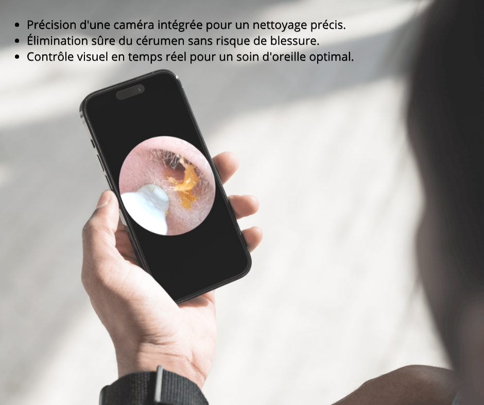 Otoview Ear Wax PRO