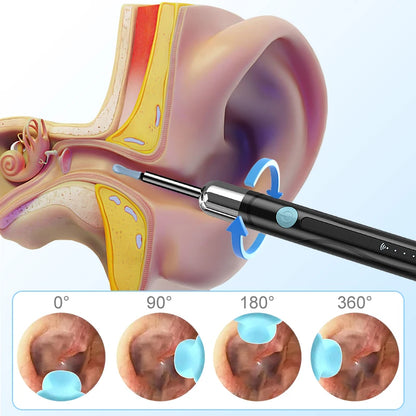 Otoview Ear Wax PRO